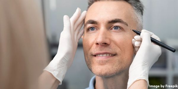 Antes y después — tratamiento de ácido hialurónico